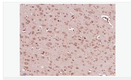 6052ae13808b2.png image.png