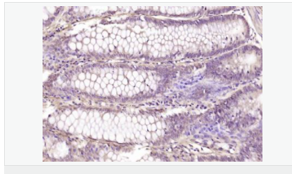 60541616d22d2.png image.png