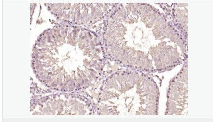 6054161d9b82f.png image.png