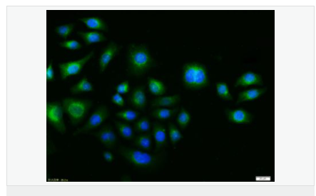 60584c9622cf0.png image.png