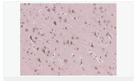 605956afb87a7.png image.png