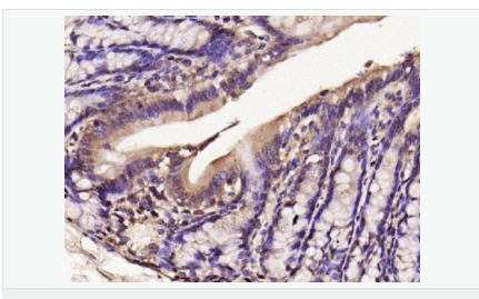 60595ced41ef0.png image.png