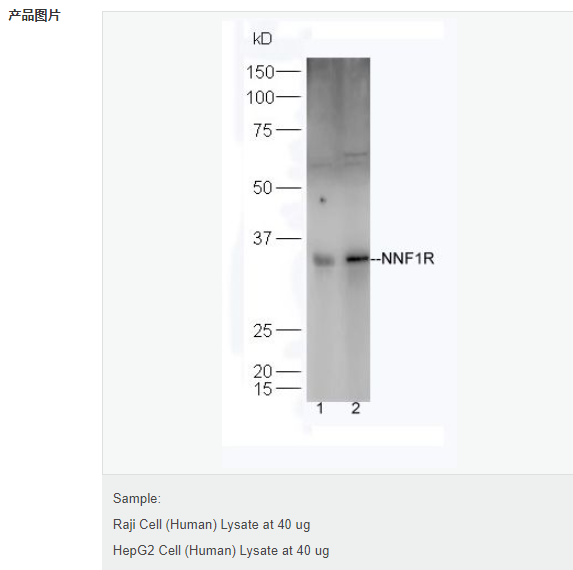 6066bd451a5f1.png image.png