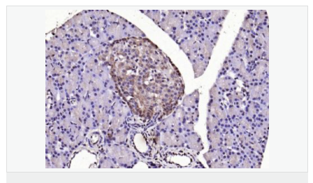 6066d489dee5c.png image.png