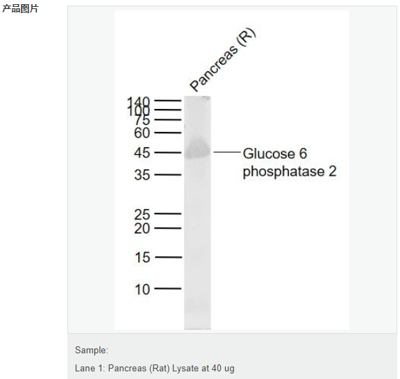 6076a6fa4c274.png image.png